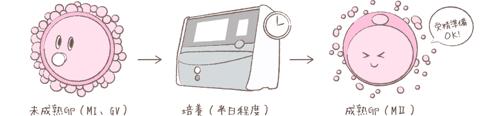 卵子の成熟度について