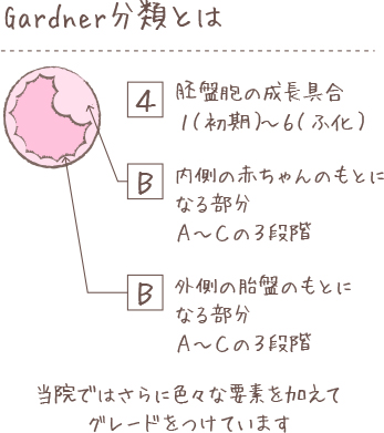 Gardner分類とは