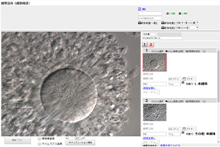 卵子ごとに写真を撮り成熟度によって管理します