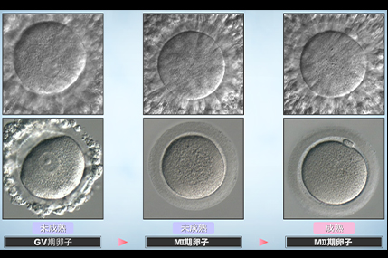 成熟卵と未熟卵