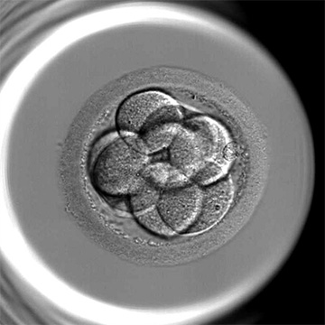 8細胞（採卵3日目
