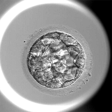 胚盤胞（採卵5日目～