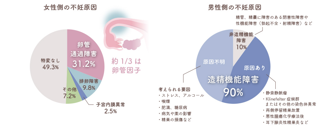 不妊原因 加藤レディスクリニック 不妊治療 体外受精