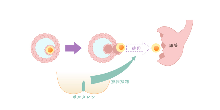 ボルタレンを使用すると卵巣から卵が出にくくなる