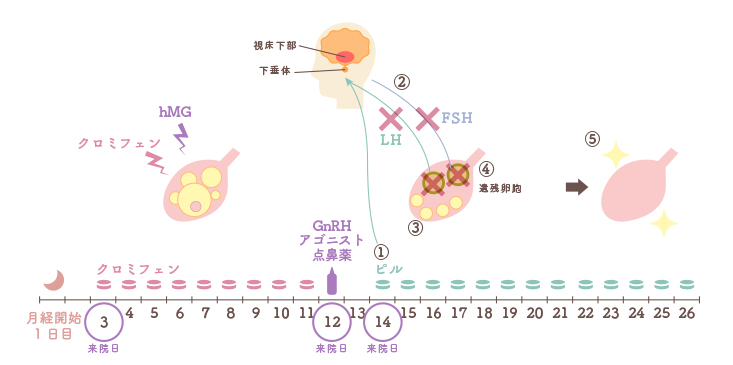 採卵後のピル内服