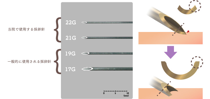 当院で使用する採卵針と一般的に使用される採卵針