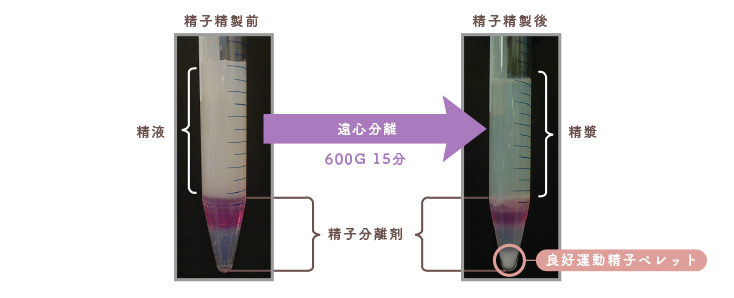 精子精製Isolate法