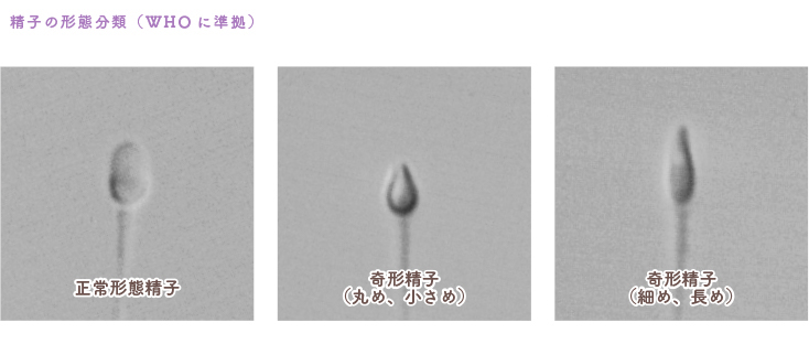 精子の形態分類(WHOに準拠)