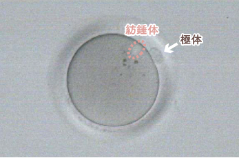 紡錘体と極体