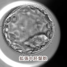 拡張中胚盤胞