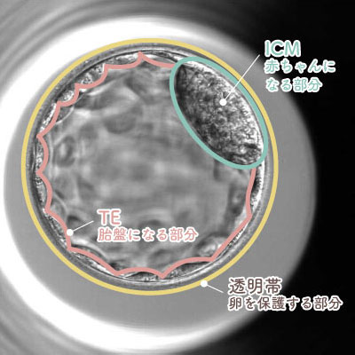 TE(胎盤になる部分)とICM(赤ちゃんになる部分)、透明帯(卵を保護する部分)