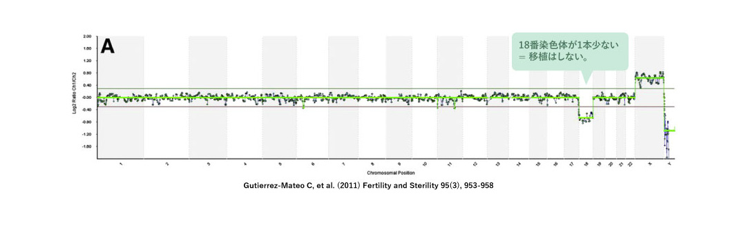 PGT-Aの方法 1. アレイCGH